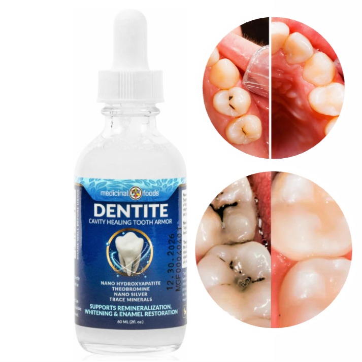 Visuel fourni montrant le flacon Dentite et des dents en comparaison
